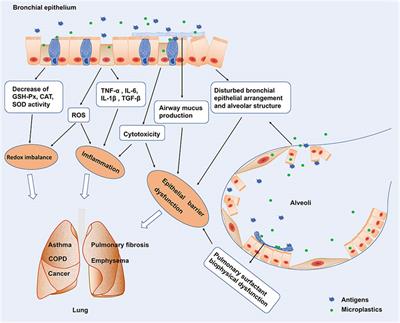 Microplastics, potential threat to patients with lung diseases